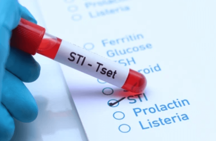 5 Reasons an At-Home STI Test is the Smarter Choice for Modern Healthcare